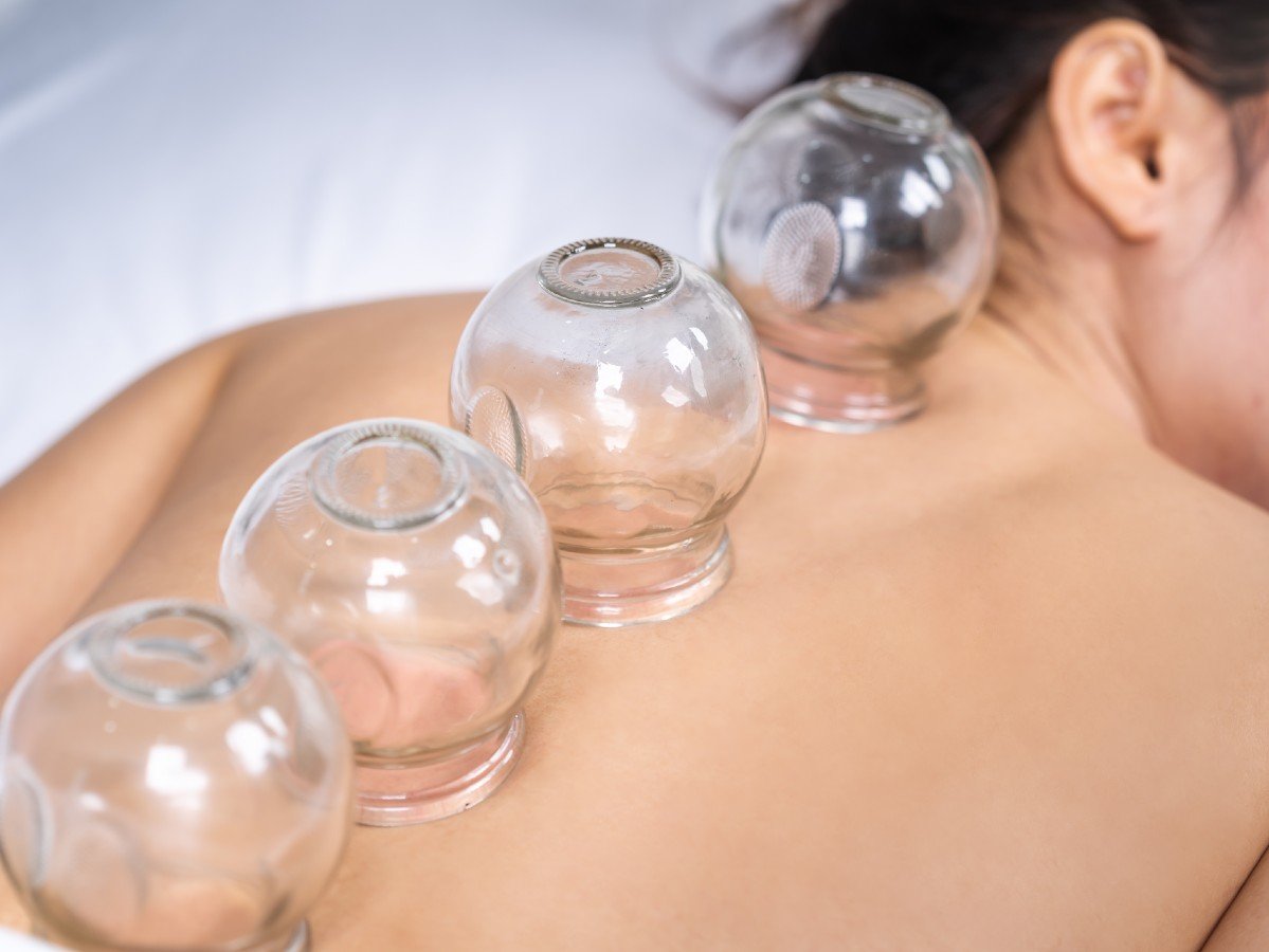 The Benefits Of Chinese Cupping Therapy Beyond Bend 1956